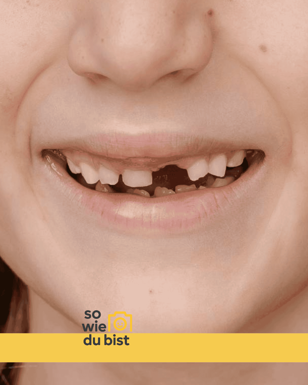 Lachendes Kind mit Milchzähnen, Nahaufnahme, authentische Schulfotografie auf Augenhöhe.